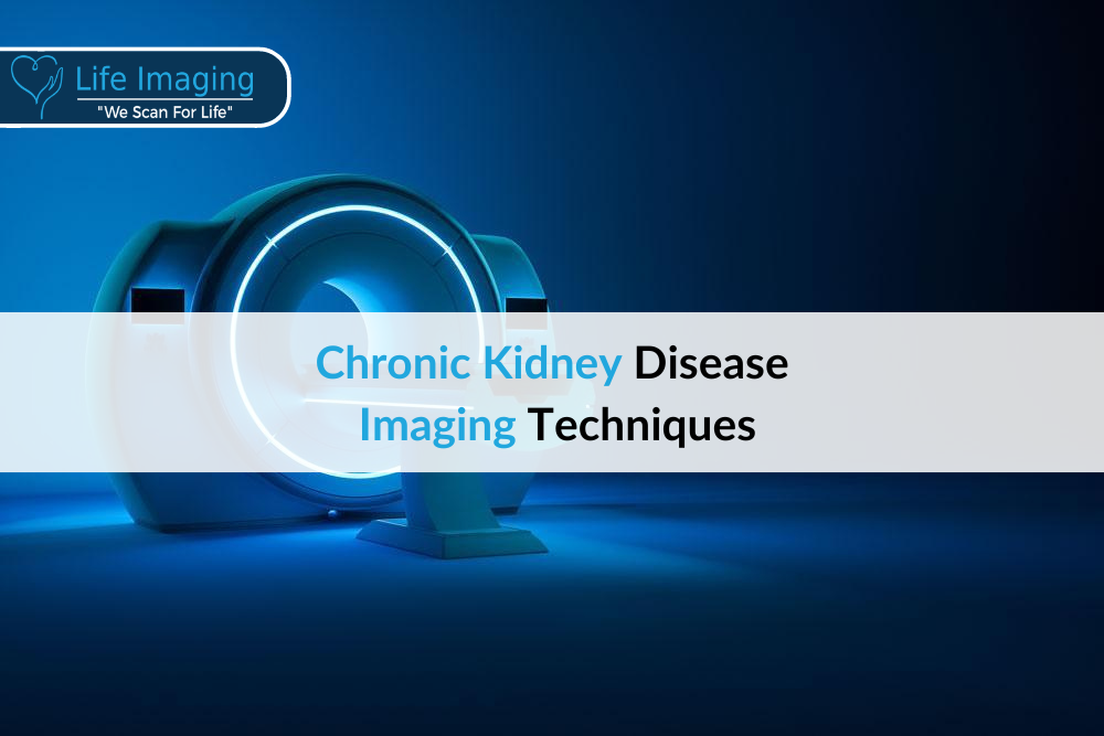 Chronic kidney disease