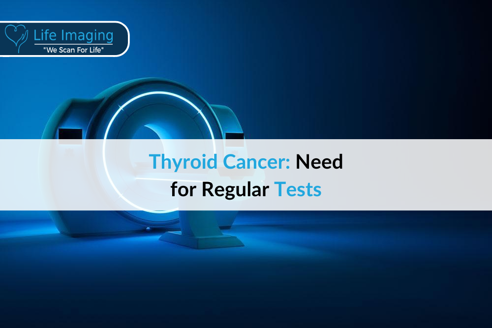 Thyroid Cancer