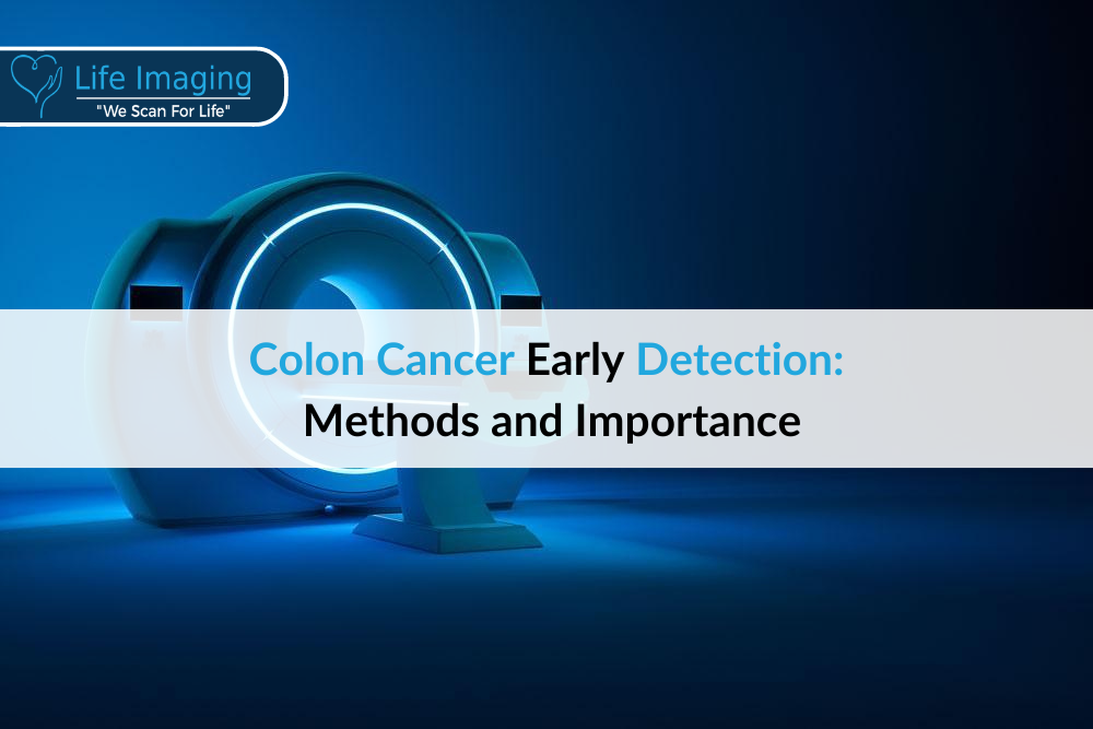 Colon Cancer