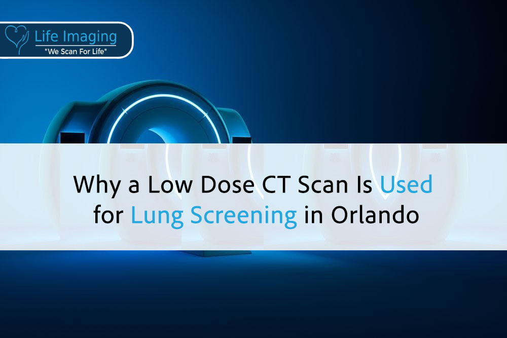 Why a Low Dose CT Scan Is Used for Lung Screening in Orlando